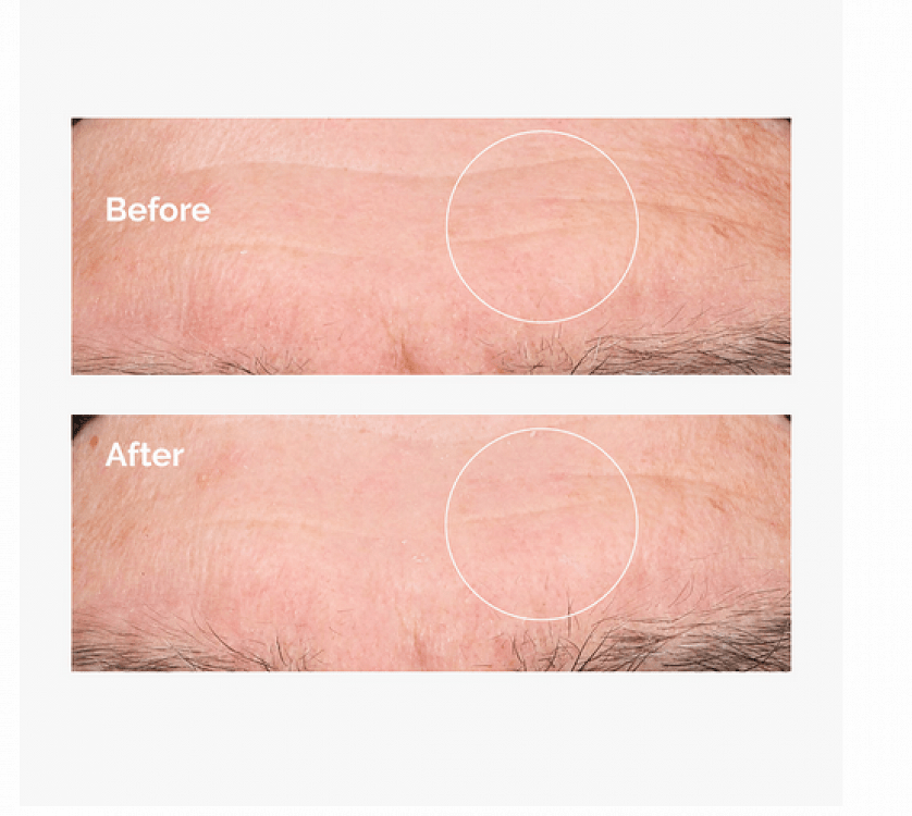 The Ordinary Hyaluronic Acid 2% + B5 Ενυδατικό & Αντιγηραντικό Serum Προσώπου με Υαλουρονικό Οξύ & Βιταμίνη B5 για Σύσφιξη 60ml