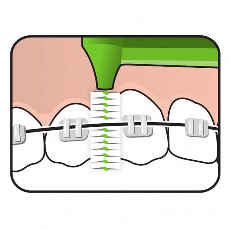 TePe Angle Μεσοδόντια Βουρτσάκια με Λαβή 0.8mm Πράσινα 6τμχ
