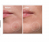 The Ordinary Sulfur 10% Powder to Cream Κρέμα Προσώπου κατά των Ατελειών & της Ακμής 5gr