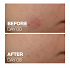 La Roche Posay Cicaplast B5 Ενυδατικό Serum Προσώπου για Λάμψη 30ml