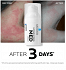 La Roche Posay Lipikar Eczema Med Cream 30ml
