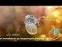 Aquilea Sueno Gummies+ Συμπλήρωμα για τον Ύπνο 30 ζελεδάκια
